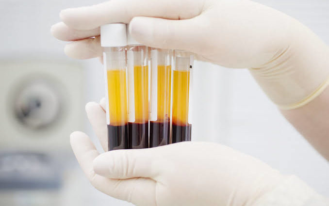 Plasma Therapy. source: statsnews